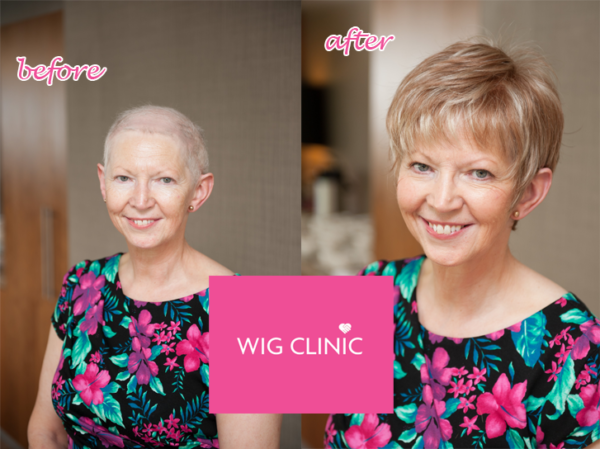 Chemotherapy Hair Loss Wig Clinic 